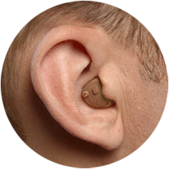 Slusni aparati - Slušni aparat iza uva