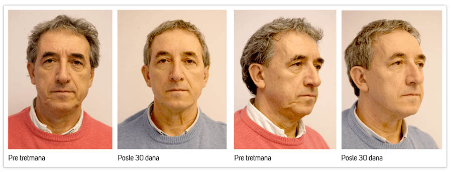 Silhouette Soft efekat