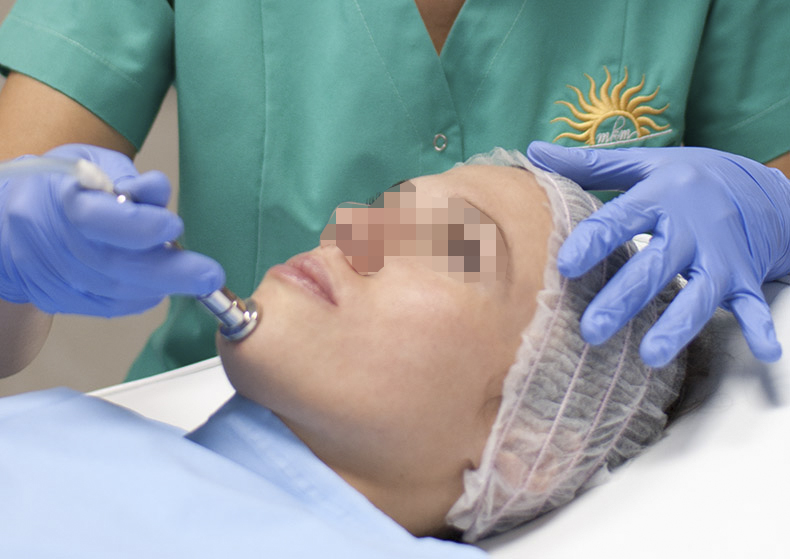 Mikrodermoabrazija tretman lica u Beogradu za obnavljanje kože.