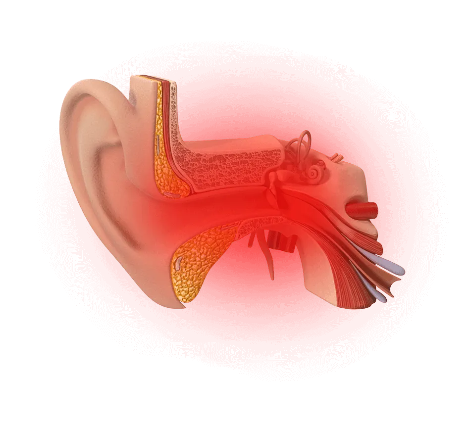 Ilustracija bola u uvu – ORL dijagnostika i lečenje u Beogradu.