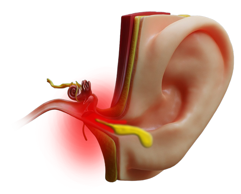 Curenje iz uva – ORL pregled i dijagnostika